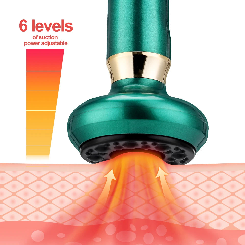 Electric Cupping Vacuum Massager